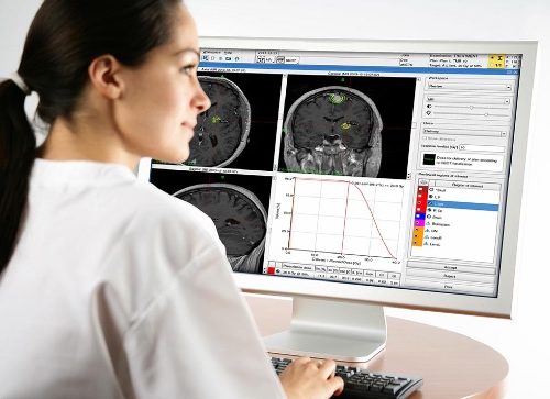 FDA approves MRI-guided focused ultrasound device to treat tremor