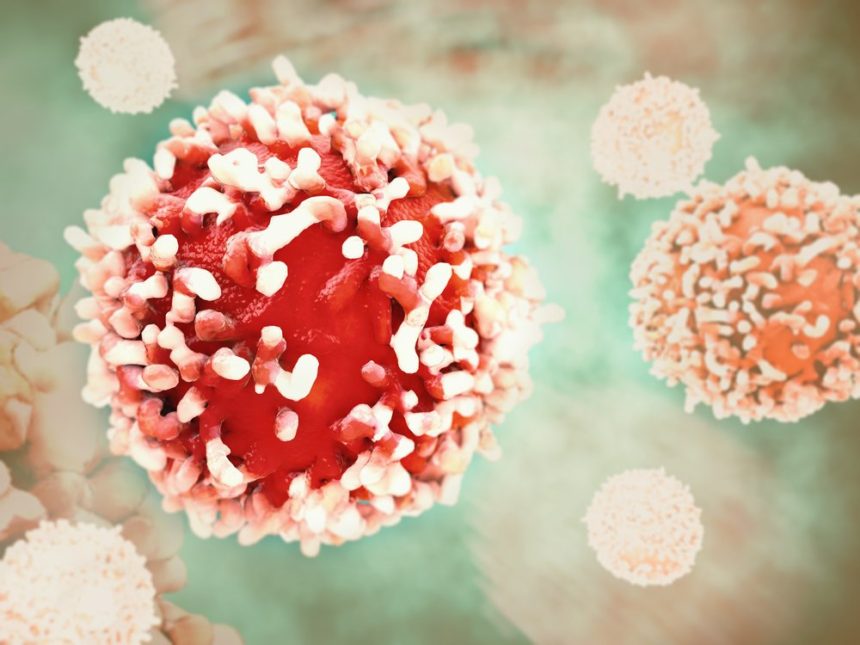 Immune Checkpoint Inhibitors Safe, Effective in HIV-positive Patients with Advanced Cancer, Research Reveals