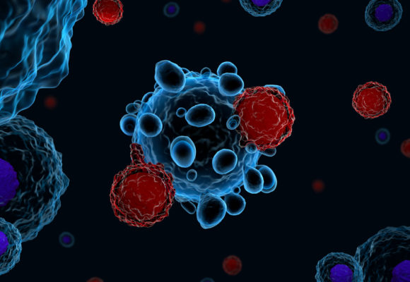 Subtypes of Immune Cells in Tumor Environment Can Predict Follicular Lymphoma Response to Therapy