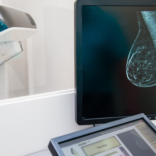 FDA Proposes New Policies to Modernize, Improve Quality of Mammography Screenings