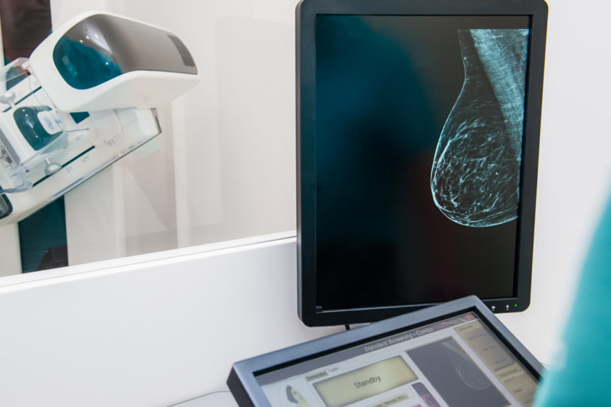 FDA Proposes New Policies to Modernize, Improve Quality of Mammography Screenings