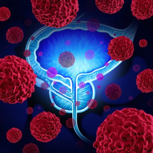 Liquid Biopsy Test Helping Select People with Advanced Prostate Cancer for Phase 2 Study of Pamiparib