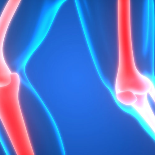 Long-term Treatment with Thiazide Diuretics May Lower Risk of Bone, Hip Fractures, Study Suggests