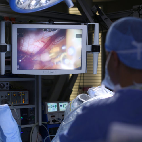 New Imaging-Guided System Helps Surgeons Remove Tiny Ovarian Tumors