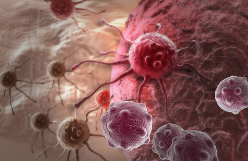 Immune Checkpoint Molecules Have Prognostic Value in Ovarian Cancer, Study Reports