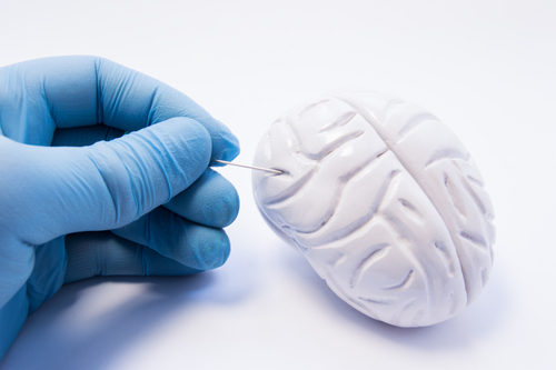 AxoSim Licenses Mini-Brain Technology to Pursue Therapies for Alzheimer’s, Other Disorders