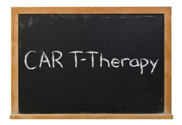 CT103A CAR T-cell Therapy Leads to Strong Anti-cancer Responses in Relapsed or Refractory Multiple Myeloma Patients, Trial Shows