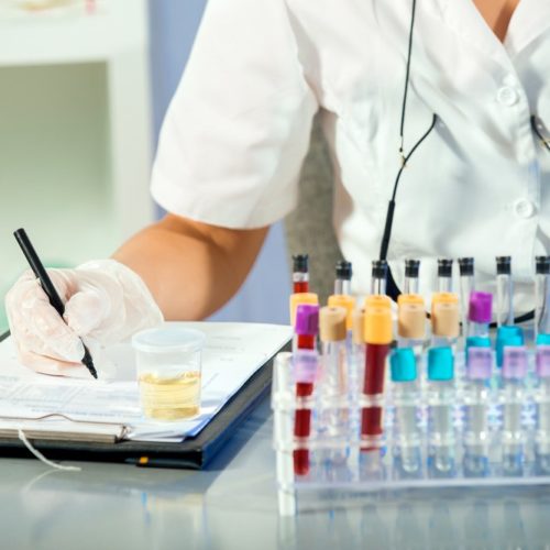 Nanostics Launches Pivotal Study to Validate ClarityDX Prostate Diagnostic Test