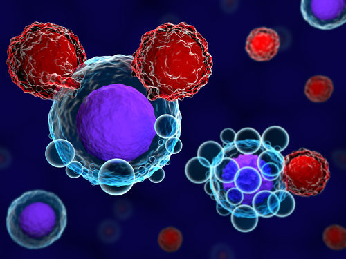 Phase 3 Trial of Topsalysin, Potential Treatment for Localized Prostate Cancer,  Planned for Europe