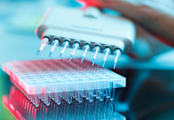 Liquid Biopsy Assay Being Utilized in Zejula Trials for PC