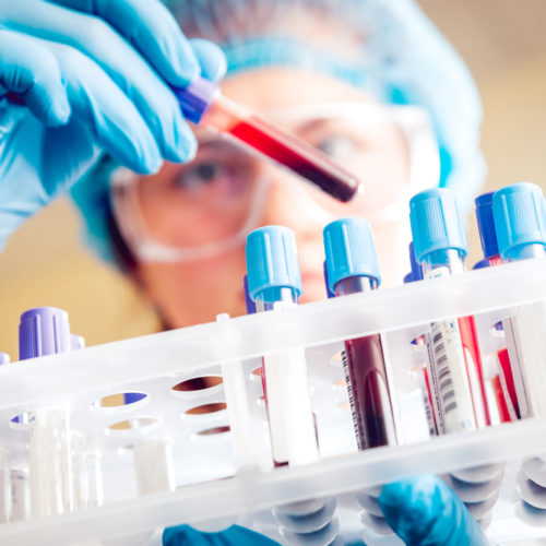 Blood Test Ably Identifies Ovarian Cancer Prior to Surgery, Clinical Trial Planned