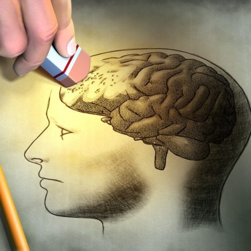 Localized and Superficial Brain PCNS Lymphomas May Benefit from Surgery, Study Reviews Suggest