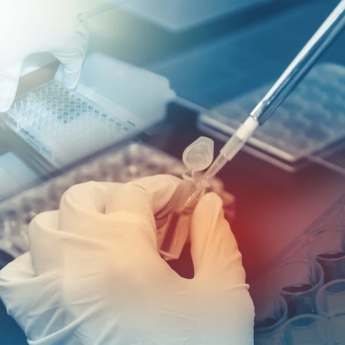 Genomic Analysis Reveals Differences Between Cancer Cell Lines and Human Cancers