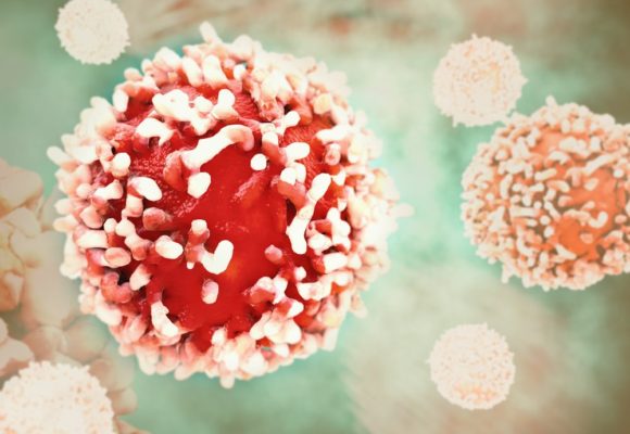 NantKwest Launches Phase 1 Trial to Assess Investigational Cell Therapy for Solid Cancers