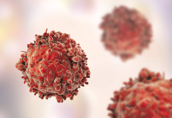 ‘Off-the-shelf’ CAR T-Cell Therapy Moving Toward 1st Clinical Trial with Takeda