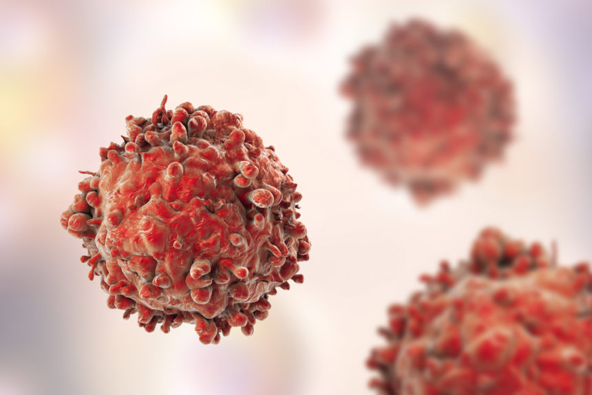 ‘Off-the-shelf’ CAR T-Cell Therapy Moving Toward 1st Clinical Trial with Takeda