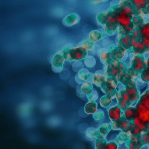 Pre-cancerous Lesions Do Not Always Lead to Ovarian Cancer, Study Finds