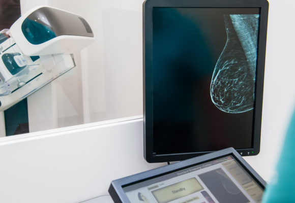 Fujifilm’s New Imaging Option Can Enhance Accuracy of Breast Biopsy