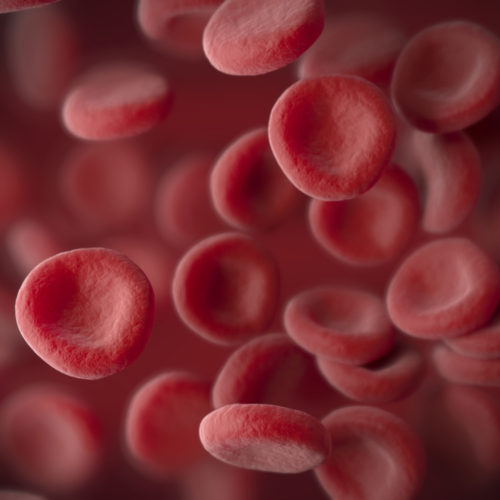 Risk of Multiple Myeloma in People with MGUS Can Rise Over Time, Study Finds