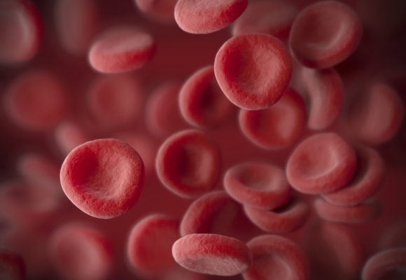 Risk of Multiple Myeloma in People with MGUS Can Rise Over Time, Study Finds