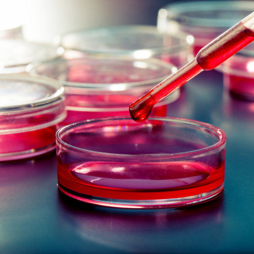 Assay Shows Potential in Predicting Ovarian Cancer Response to Chemotherapy