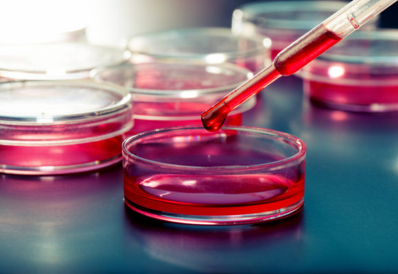 Assay Shows Potential in Predicting Ovarian Cancer Response to Chemotherapy