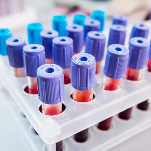 Collaborators Aim to Identify OC Patients Likely to Benefit from New Combo Therapy