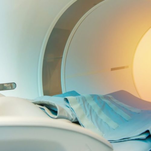 PSMA PET-CT Offers Better Detection Rates in Recurrent PC, Study Says