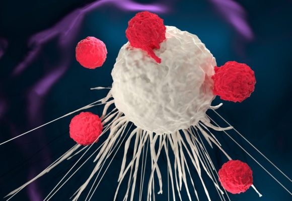 Fate Therapeutics Plans Trials Testing Off-the-shelf NK Cell Therapy for Lymphoma, Leukemia