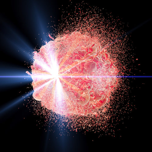 Focal Therapy, AuroLase, Shows Good Safety and Potential Effectiveness in Pilot Clinical Trial