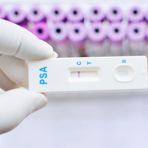 FDA Grants Breakthrough Device Designation to IsoPSA Blood Test for Early Prostate Cancer Diagnosis