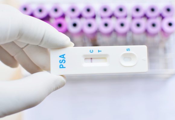 FDA Grants Breakthrough Device Designation to IsoPSA Blood Test for Early Prostate Cancer Diagnosis