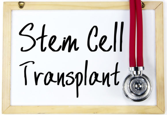 Orencia Given FDA’s Breakthrough Status as Treatment to Prevent Graft-versus-Host Disease After Stem Cell Transplant