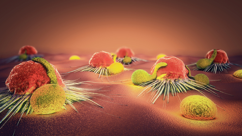Uppsala in Last Preclinical Stage for New CAR T-cell Product for Glioblastoma