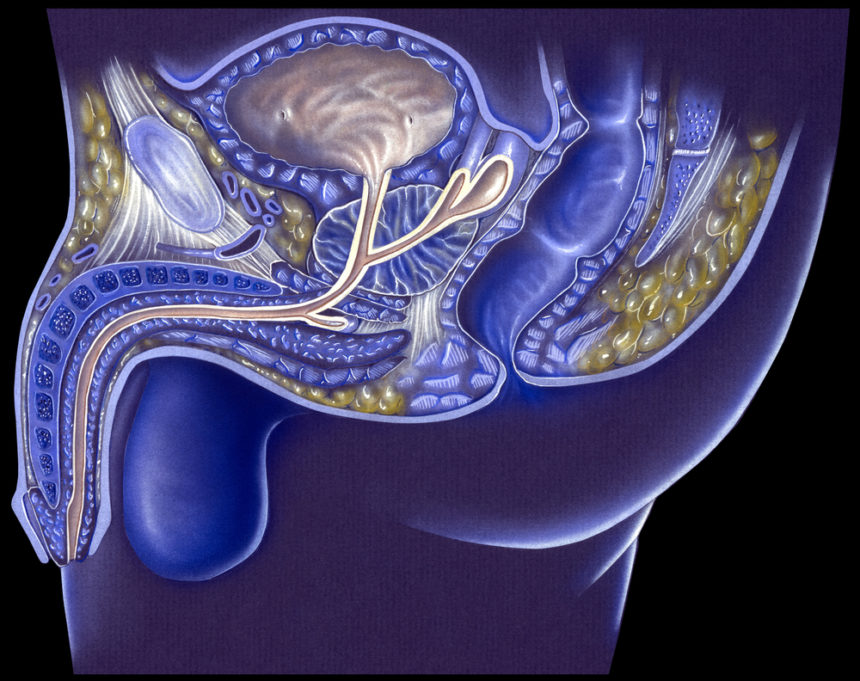 Laser Focal Therapy Effective, Causes Few Side Effects, 10-Year Trial Data Shows