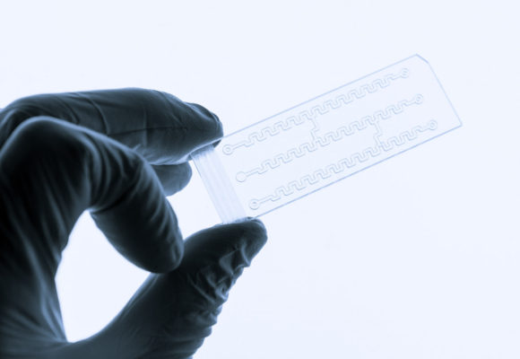 Organ-on-a-chip Device Shows How Cancer Cells Interact With Platelets to Drive Metastasis