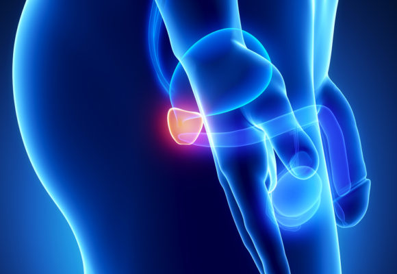 NIH Grants Dartmouth Team $2.5M to Develop Device for Detecting Cancer Cells