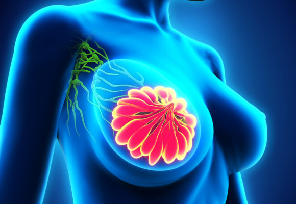 Imagio Imaging System for Breast Cancer Diagnosis Approved by FDA