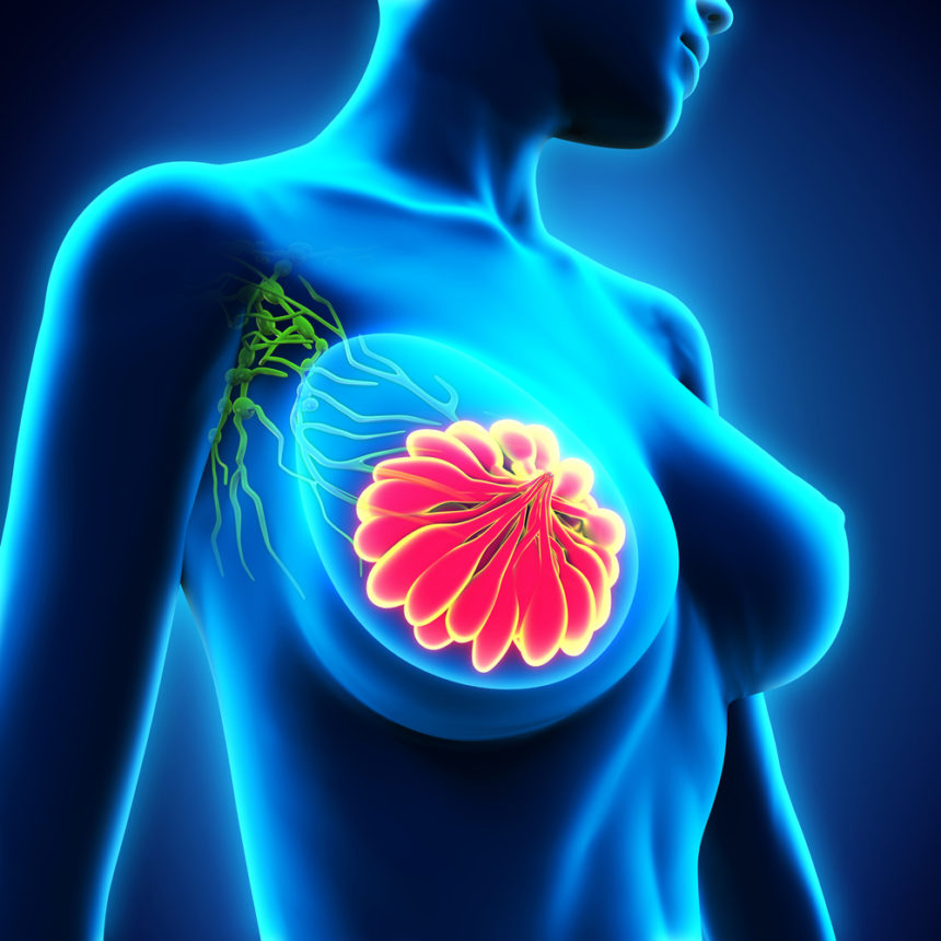 Imagio Imaging System for Breast Cancer Diagnosis Approved by FDA