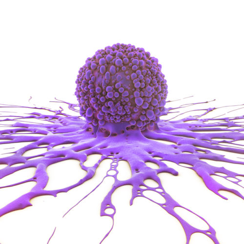 Blocking Glutamine Metabolism May Help Combat OCCC Tumors