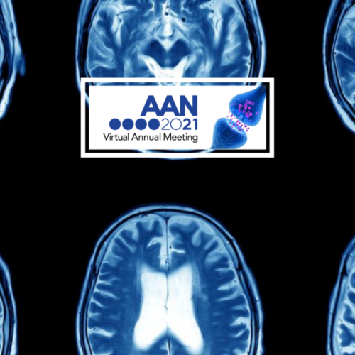 #AANAM – Lecanemab Safely, Quickly Lowers Amyloid Clumps in Trial