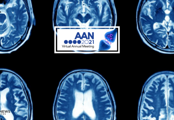 #AANAM – Lecanemab Safely, Quickly Lowers Amyloid Clumps in Trial