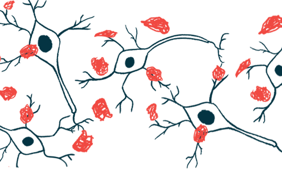 Eisai Starting Rolling Submission to FDA for Lecanemab Approval